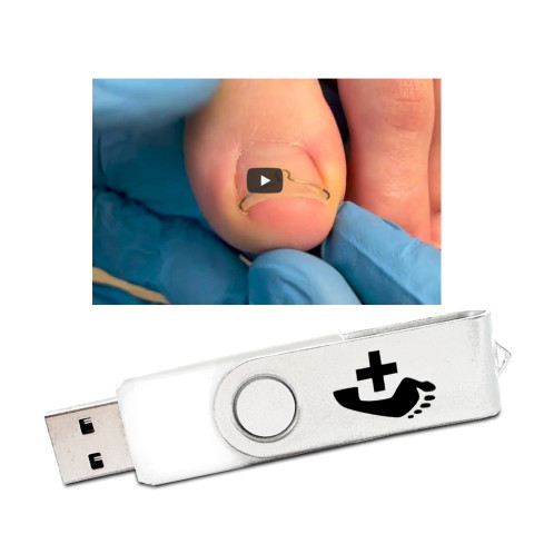 'Unguisan® Classic Schulungsfilm (USB-Stick)'