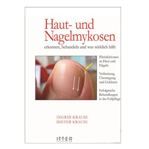 'Haut- und Nagelmykosen'